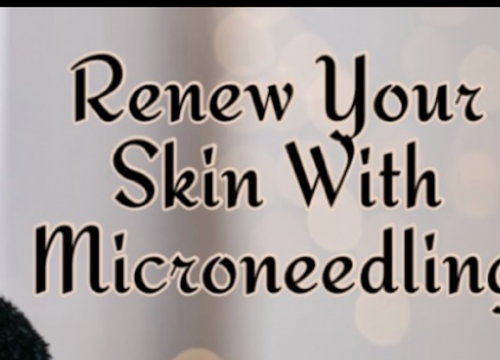 Renew Your Skin With Microneedling Virtual Event